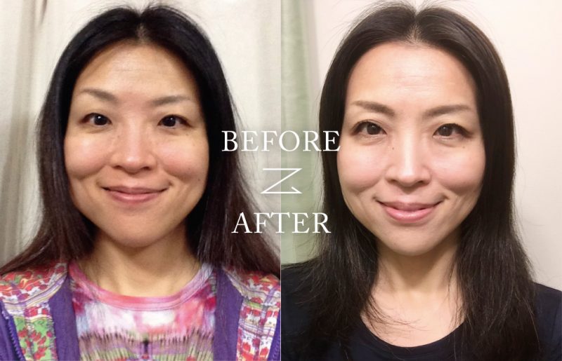 顔ヨガ　飯田順子 Before＆After