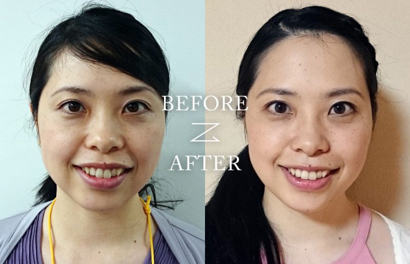 市川愛子Before After