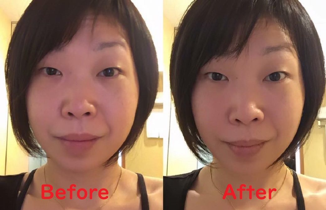 さかたのりこ先生の顔Before＆After