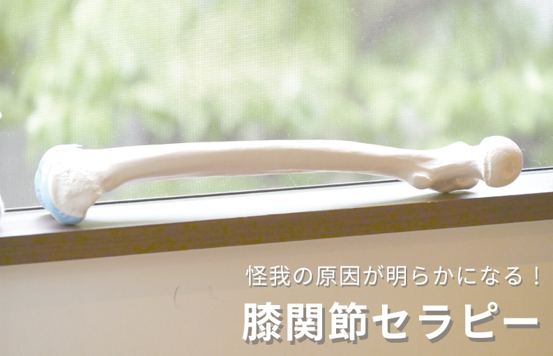 窓際においてある大腿骨の模型