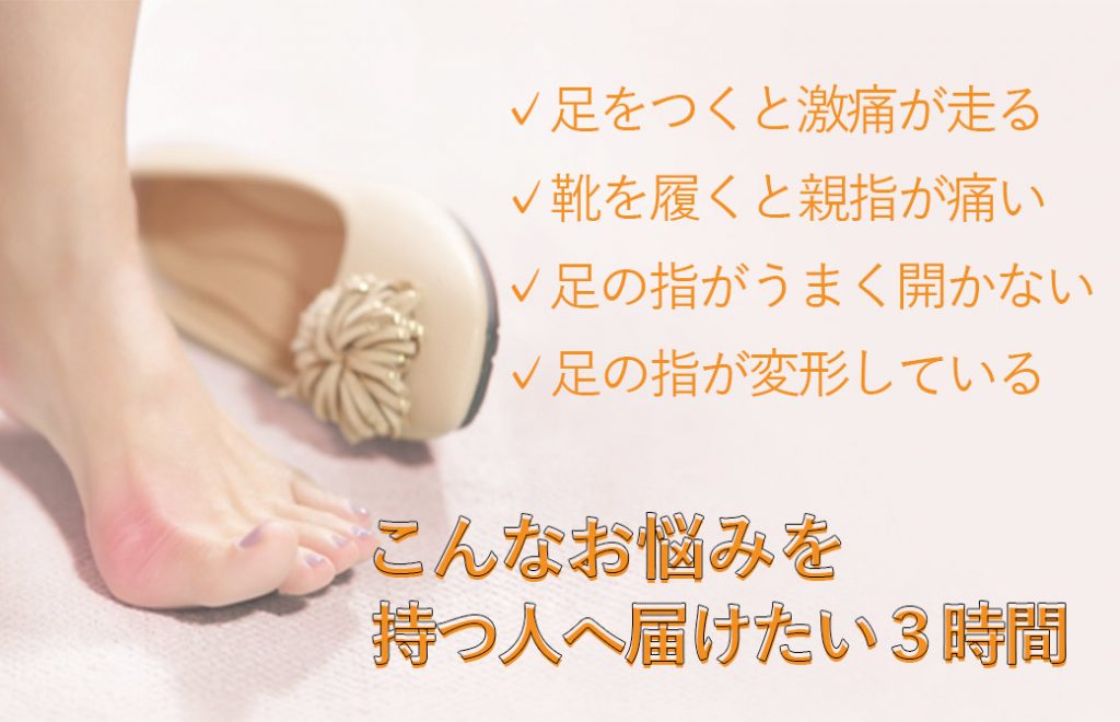外反母趾の女性